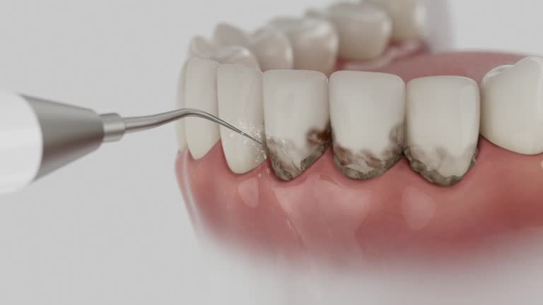 Reliable Dental contractor in Markle, IN by Dentist Open Now